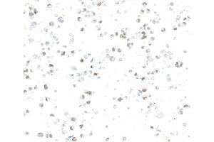 Immunocytochemistry (ICC) image for anti-Jumonji Domain Containing 6 (JMJD6) (AA 125-175) antibody (ABIN7795645)