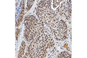 IHC analysis of XRCC4 using anti-XRCC4 antibody (ABIN7599168).