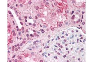 Image no. 5 for anti-Hypoxia Inducible Factor 1, alpha Subunit (Basic Helix-Loop-Helix Transcription Factor) (HIF1A) (AA 432-528) antibody (ABIN2852421)