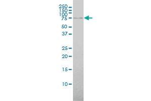 ABCF2 monoclonal antibody (M01), clone 1D11 Western Blot analysis of ABCF2 expression in Hela .
