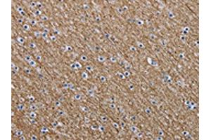 The image is immunohistochemistry of paraffin-embedded Human brain tissue using ABIN7191618(NEFM Antibody) at dilution 1/20. (NEFM anticorps)
