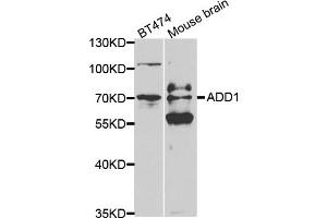 Western blot analysis of extracts of various cell lines, using ADD1 antibody (ABIN5970770) at 1/500 dilution. (alpha Adducin anticorps)
