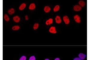 Confocal immunofluorescence analysis of HeLa cells using DNMT1 Polyclonal Antibody at dilution of 1:100. (DNMT1 anticorps)