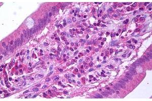 Anti-VEGFR3 antibody IHC staining of human small intestine.