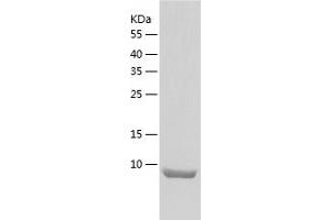 Western Blotting (WB) image for Osteocrin (OSTN) (AA 28-133) protein (His-IF2DI Tag) (ABIN7124279)