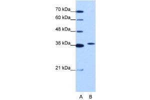 WB Suggested Anti-EXOSC7  Antibody Titration: 1. (EXOSC7 anticorps  (N-Term))