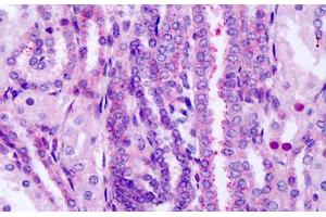 Anti-FZD8 / Frizzled 8 antibody IHC staining of human fetal kidney.