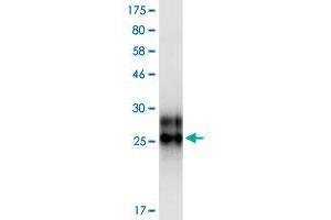 Western Blotting (WB) image for Tumor Necrosis Factor Receptor Superfamily, Member 19 (TNFRSF19) (AA 30-170) protein (His-DYKDDDDK-Strep II Tag) (ABIN4369899) (TNFRSF19 Protein (AA 30-170) (His-DYKDDDDK-Strep II Tag))