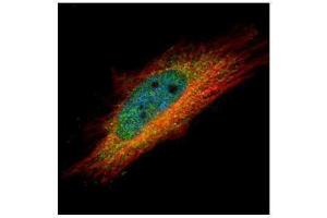 ICC/IF Image Confocal immunofluorescence analysis (Olympus FV10i) of paraformaldehyde-fixed HeLa, using IP6K1, antibody (Green) at 1:500 dilution.