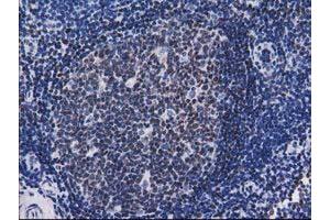 Image no. 2 for anti-CTD (Carboxy-terminal Domain, RNA Polymerase II, Polypeptide A) Small Phosphatase 1 (CTDSP1) antibody (ABIN1497678) (CTDSP1 anticorps)