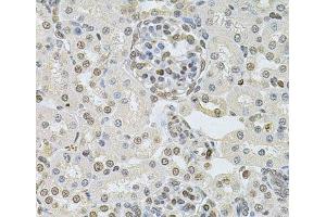 Immunohistochemistry of paraffin-embedded Rat kidney using DR1 Polyclonal Antibody at dilution of 1:100 (40x lens). (DR1 anticorps)
