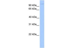 Western Blotting (WB) image for anti-Nucleoporin 98kDa (NUP98) antibody (ABIN2463586) (NUP98 anticorps)
