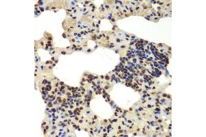 Immunohistochemistry of paraffin-embedded rat lung using DDX5 antibody (ABIN6291987) at dilution of 1:100 (40x lens).