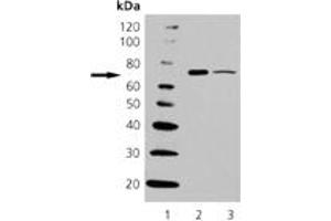 Western Blotting (WB) image for anti-Heat Shock 70kDa Protein 6 (HSP70B') (HSPA6) (C-Term) antibody (ABIN7211463) (HSPA6 anticorps  (C-Term))