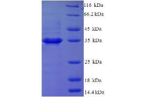 SDS-PAGE (SDS) image for Glutaminyl-Peptide Cyclotransferase-Like (QPCTL) (AA 212-382), (partial) protein (His-SUMO Tag) (ABIN5711815)