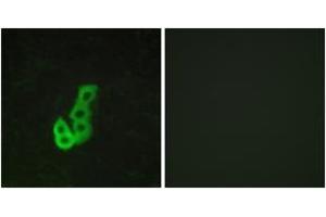 Immunofluorescence analysis of MCF7 cells, using DRD1 Antibody.