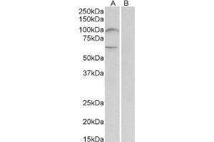 ABIN2560674 (2µg/ml) staining of Human Bone Marrow lysate (35µg protein in RIPA buffer) with (B) and without (A) blocking with the immunizing peptide. (UNC5B anticorps  (AA 629-643))