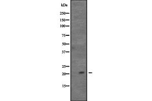 Western blot analysis of CDC42 expression in Hela cell lysate,The lane on the left is treated with the antigen-specific peptide. (CDC42 anticorps  (Internal Region))