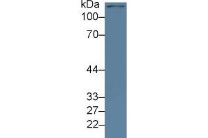 Detection of KDM4A in Mouse Cerebrum lysate using Polyclonal Antibody to Lysine Specific Demethylase 4A (KDM4A) (KDM4A anticorps  (AA 141-310))