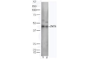 Lane 1: Human Raji lysates; Lane 2: Mouse spleen lysates probed with Rabbit Anti-ZNT8 Polyclonal Antibody, Unconjugated (ABIN1714639) at 1:300 overnight at 4˚C.