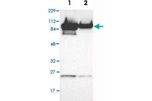 Western Blot analysis of Lane 1: RT-4 and Lane 2: U-251MG sp cell lysates with AKAP8 polyclonal antibody . (AKAP8 anticorps)