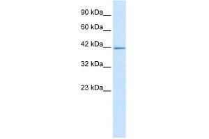 WB Suggested Anti-ZNFN1A2 Antibody Titration: 5. (IKZF2 anticorps  (C-Term))