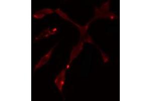 anti-Polymerase (DNA Directed), delta 1, Catalytic Subunit 125kDa (POLD1) (C-Term) antibody