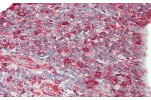 Detection of CD86 in Human Tonsil Tissue using Polyclonal Antibody to Cluster Of Differentiation 86 (CD86)