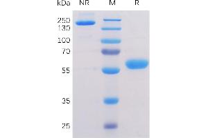 Human A1 Protein, mFc-His Tag on SDS-PAGE under non-reducing (NR) and reducing (R) conditions.