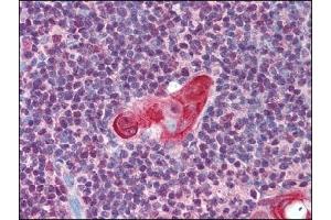 Image no. 1 for anti-T-Cell Leukemia Homeobox 1 (TLX1) (AA 300-330) antibody (ABIN372448) (TLX1 anticorps  (AA 300-330))