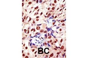 anti-Protein Arginine Methyltransferase 2 (PRMT2) (AA 22-53), (N-Term) antibody