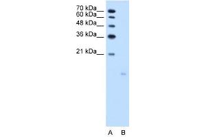 PPFIBP1 antibody used at 2.