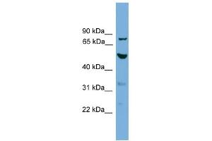 WB Suggested Anti-TUBA8 Antibody Titration: 0. (TUBA8 anticorps  (N-Term))