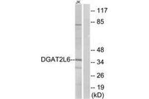 Western blot analysis of extracts from Jurkat cells, using DGAT2L6 Antibody. (DGAT2L6 anticorps  (AA 271-320))