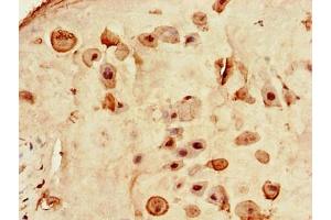 Immunohistochemistry of paraffin-embedded human placenta tissue using ABIN7167815 at dilution of 1:100