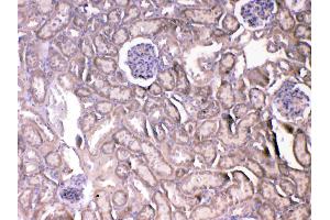 IHC analysis of VEGF Receptor 2 using anti-VEGF Receptor 2 antibody .
