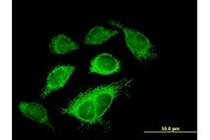 Immunofluorescence of purified MaxPab antibody to IDH3A on HeLa cell.
