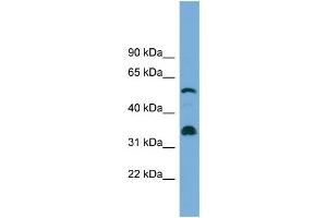 WB Suggested Anti-CYP26B1 Antibody Titration: 0. (CYP26B1 anticorps  (Middle Region))