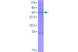 Image no. 1 for Agmatine Ureohydrolase (Agmatinase) (AGMAT) (AA 1-352) protein (GST tag) (ABIN1344571)