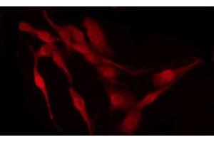 ABIN6267289 staining MDA-MB-435 by IF/ICC.