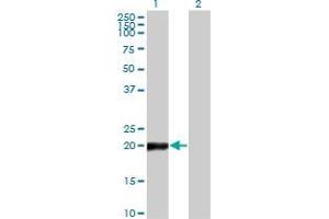 Western Blot analysis of COPS8 expression in transfected 293T cell line by COPS8 monoclonal antibody (M04), clone 2G8. (COPS8 anticorps  (AA 1-209))