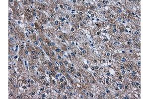 Image no. 1 for anti-V-Akt Murine Thymoma Viral Oncogene Homolog 2 (AKT2) antibody (ABIN1496564) (AKT2 anticorps)