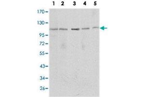 Western blot analysis using SIRT1 monoclonal antobody, clone 1F3  against MCF-7 (1), Jurkat (2), HeLa (3), HEK293 (4) and A-549 (5) cell lysate. (SIRT1 anticorps)