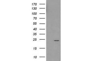 Western Blotting (WB) image for anti-Haloacid Dehalogenase-Like Hydrolase Domain Containing 1 (HDHD1) antibody (ABIN1498624) (HDHD1 anticorps)