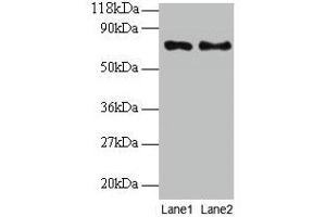 Western blot All lanes: TAX1BP3 antibody at 2 μg/mL Lane 1: EC109 whole cell lysate Lane 2: 293T whole cell lysate Secondary Goat polyclonal to rabbit IgG at 1/15000 dilution Predicted band size: 14 kDa Observed band size: 70 kDa (TAX1BP3 anticorps  (AA 1-124))