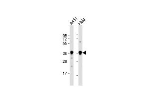 All lanes : Anti-GDH Antibody (C-term ) at 1:1000 dilution Lane 1: A431 whole cell lysate Lane 2: Hela whole cell lysate Lysates/proteins at 20 μg per lane. (GAPDH anticorps  (C-Term))