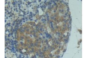 Detection of FASL in Rat Pancreas Tissue using Polyclonal Antibody to Factor Related Apoptosis Ligand (FASL) (FASL anticorps  (AA 100-278))