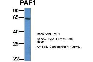 Host: Rabbit  Target Name: PAF1  Sample Tissue: Human Fetal Heart  Antibody Dilution: 1.