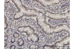 Immunoperoxidase of monoclonal antibody to MEF2A on formalin-fixed paraffin-embedded human small Intestine. (MEF2A anticorps  (AA 71-170))