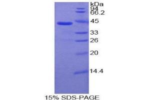 SDS-PAGE (SDS) image for Interleukin 7 Receptor (IL7R) (AA 173-260) protein (His tag,GST tag) (ABIN1879125)